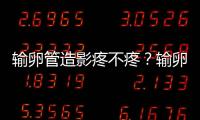 输卵管造影疼不疼？输卵管造影的过程